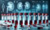 Kidney Blood Test Insights for Residents of Blackburn