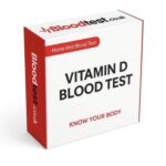 Vitamin D Blood Test Process and Its Importance in Bolton